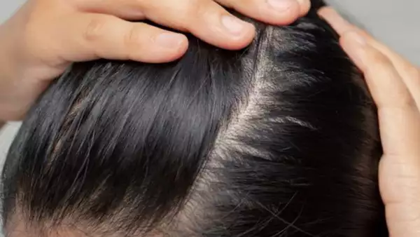 Balon Ki Nashaonuma Ke Liye Behtareen Patay: Khubsurat Aur Sehatmand Baal Paayein - Which leaves is best for hair growth?