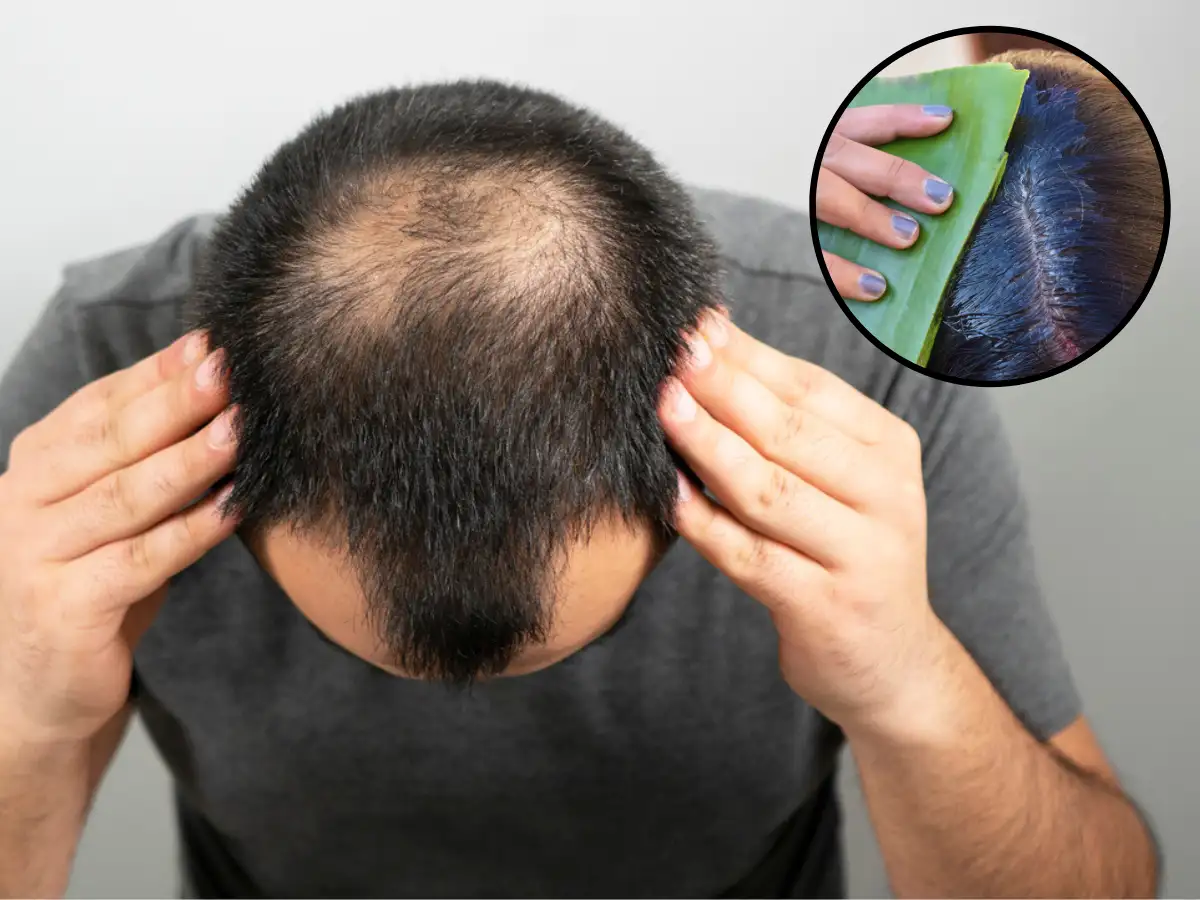 Balon Ki Narmayi Aur Unki Safai Ke Liye Aloe Vera Ke Faide: Ganje Sir Par Jaldi Baal Agane Ke Asan Tareeqay - Benefits of Aloe Vera for Hair Growth & Thickness