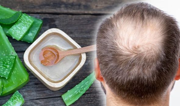 Kya Aloe Vera Ganje Dhabo Par Baal Uga Sakta Hai? - Can aloe vera regrow baldness?