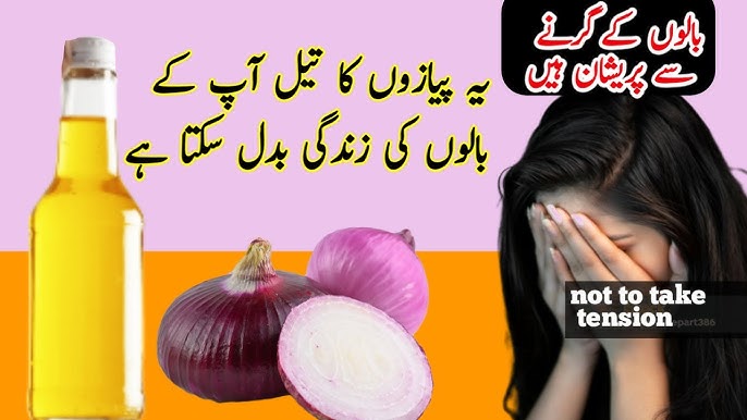 10 Asan Gharelo Tareeqay Jo Aapko Onion Hair Oil Banane Mein Madad Dain Gay - پیاز کا تیل