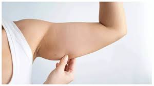 Flabby arms holding you back? These 3 exercises will help