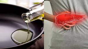 5 best cooking oils to avoid fatty liver disease - فیٹی جگر کی بیماری سے بچنے کے لیے کھانا پکانے کے 5 بہترین تیل